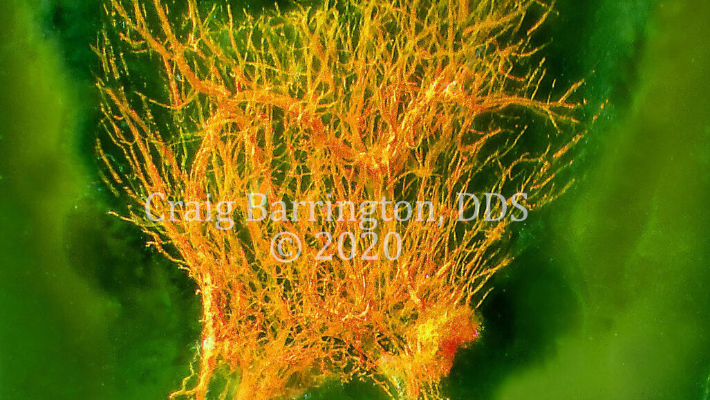 Advances in diaphanization and photography reveal wonders of dental pulp chamber