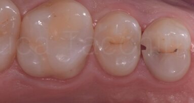 La gestione del punto di contatto nelle II classi