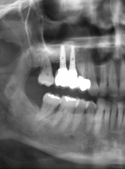 Figg. 16, 17_Opt finale e opt di controllo a 14 mesi dal carico.