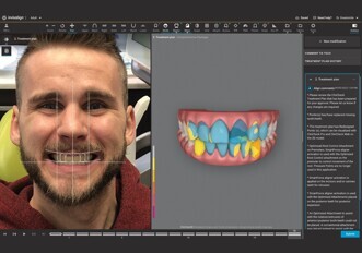 Align Technology – Invisalign Smile Architect