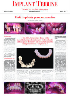Implant Tribune France No. 1, 2025