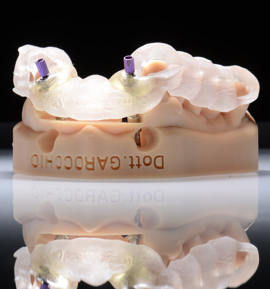 Fig. 39 - Alloggiamento definitivo