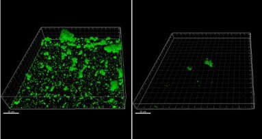 Aminoácido natural comum pode tornar-se novo meio de controlar biofilme dental