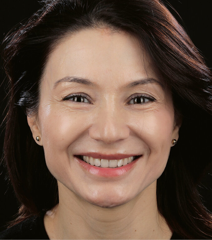 Fig. 16. Portrait image after completion of the restoration