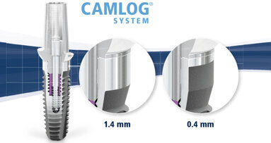 Interview: “Are your workflows perio-friendly and efficient?”