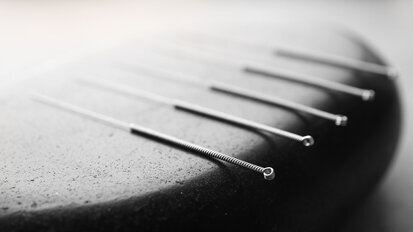 אקופונקטורה בטיפול בקסרוסטומיה, חרדה דנטלית ורפלקס הקאה