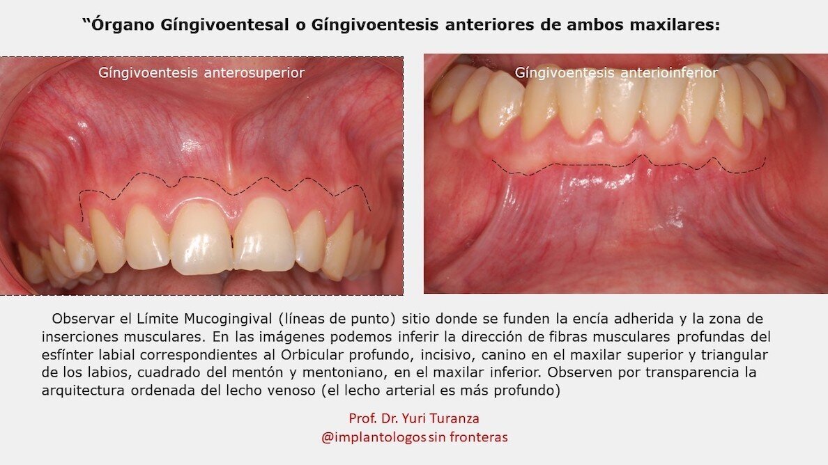 La implantología que no vemos