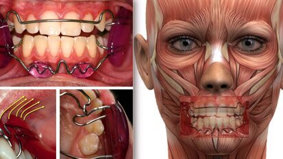 Los beneficios en la salud general de la Ortodoncia Médica