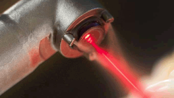 Aplicaciones clínicas de los láseres de Er:YAG y de Er,Cr:YSGG