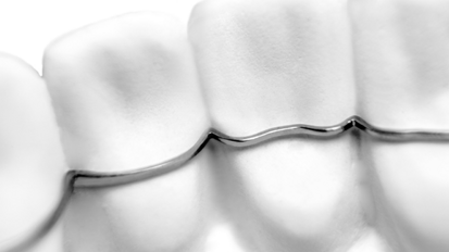 KFO-Apparaturen im digitalen Workflow: Sirona kooperiert mit CA DIGITAL