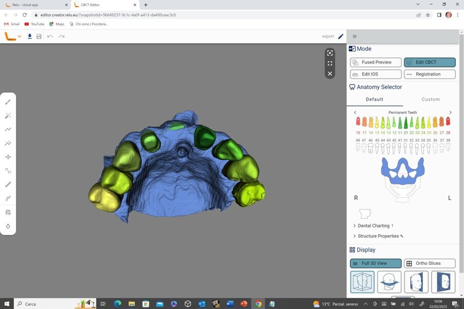Fig. 6_La stessa area rigenerata è stata correttamente segmentata.
