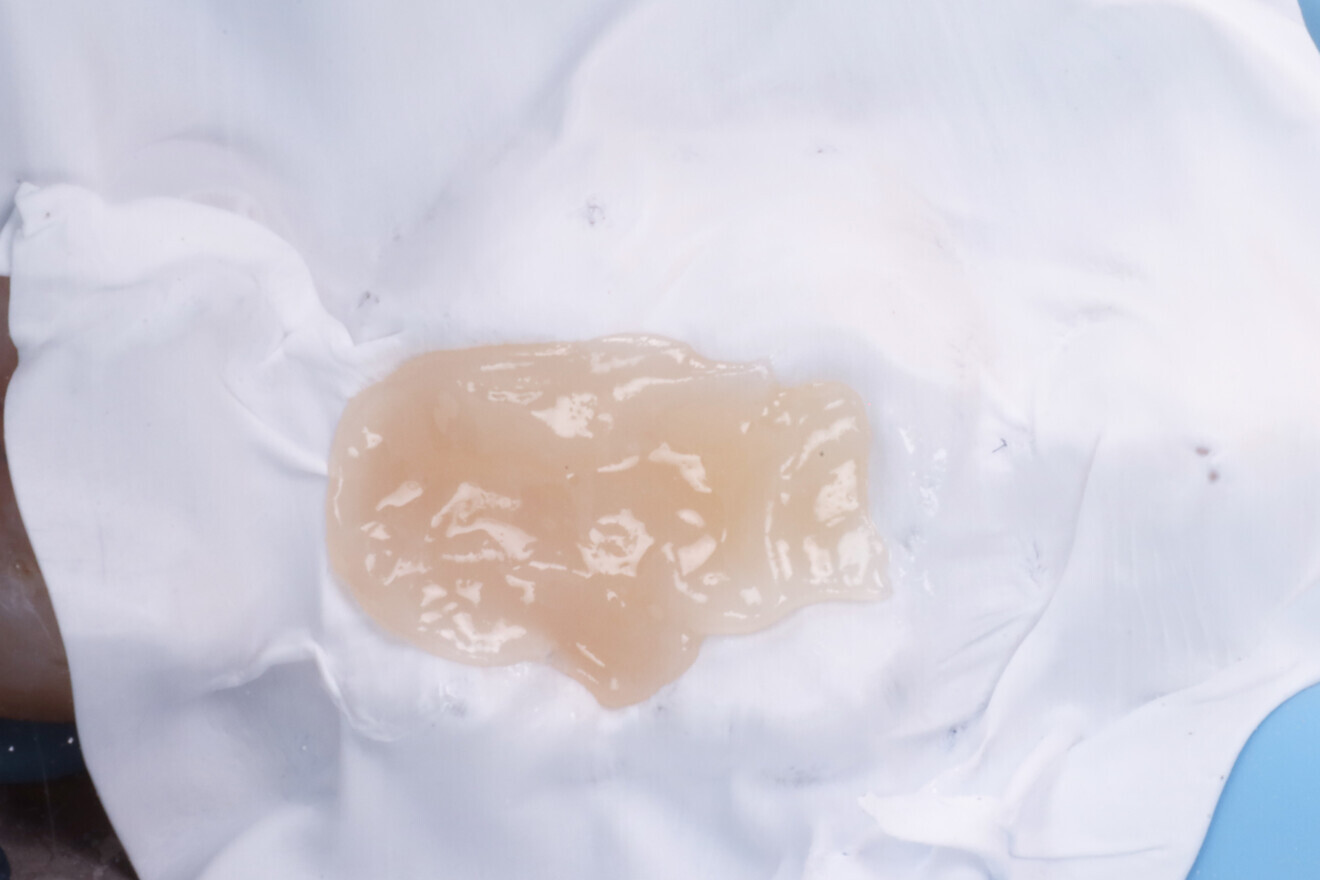 Fig. 16: Occlusal enamel composite before polymerisation.