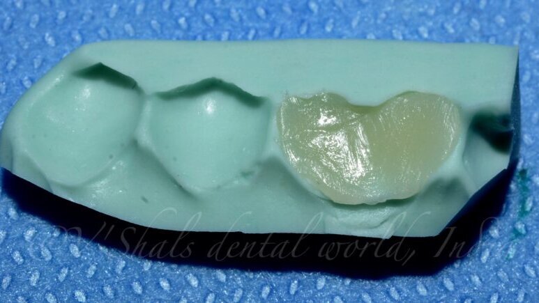 Custom shield Technique