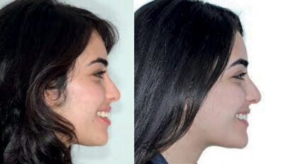 Can we treat patients in fewer visits?