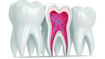 UB receives grant to improve vital pulp therapy, a root canal treatment alternative