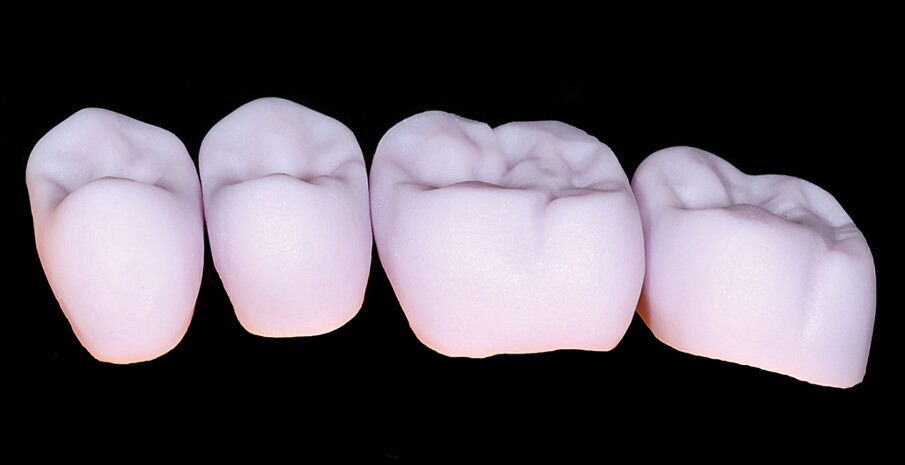 Fig. 7: Crowns directly after having been ground from IPS e.maxCAD LT