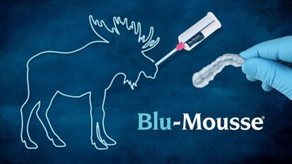 DirectaDentalGroup – Parkell – Blu-Mousse Video Testimonial by Dr. Glenn Goodhart, DDS