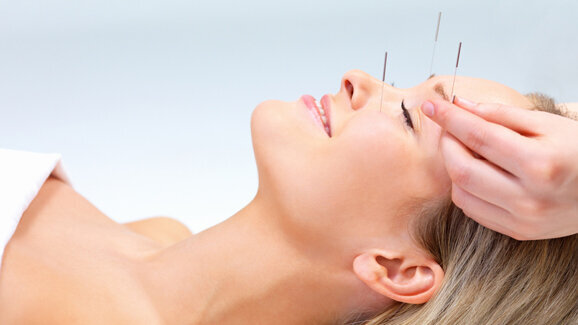 Akupunktur verringert Zahnarzt-Angst