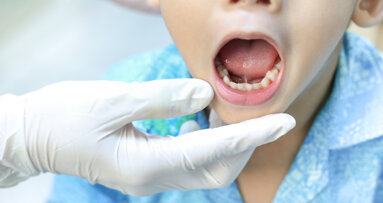 Study highlights barriers to dental care for UAE children with special needs