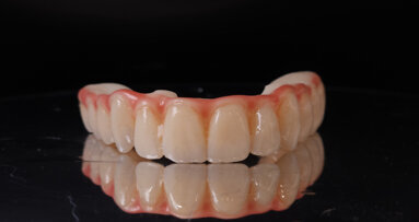 Asiga’s open operating environment is advancing additive manufacturing