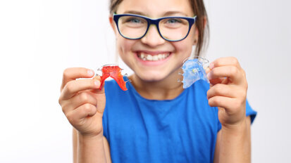 Severe overjet better treated from an early age