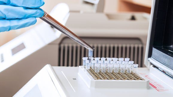 הצגת שיטה אלטרנטיבית לסיווג מחלת חניכיים