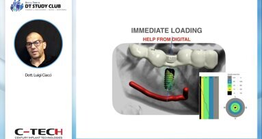 Pianificazione digitale e chirurgia guidata: flusso di lavoro e suggerimenti eseguirle al meglio