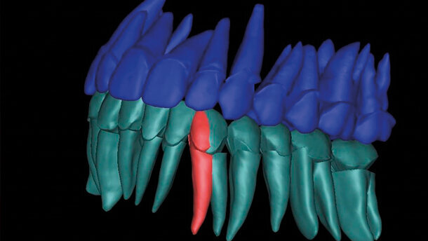 Ortodonzia 4D: dalla diagnosi morfologica al fattore tempo