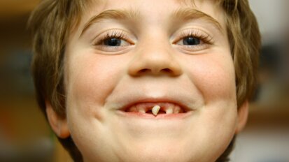 Bijna één op de vijf kinderen niet naar tandarts