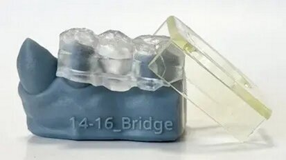 Výzkumníci vyvinuli novou techniku rekonstrukce zubů využívající 3D tisk