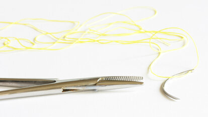 Neue Methode zum Wundverschluss