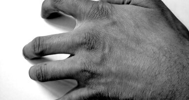 Valutazione del rischio stress nello Studio del dentista