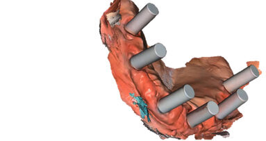 Software enhancements support a higher level of performance for Primescan and CEREC Primemill