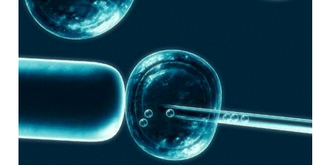 Pulpe dentaire pour les banques de cellules souches !