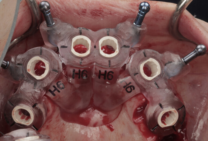 Fig. 9b: ... and in situ.
