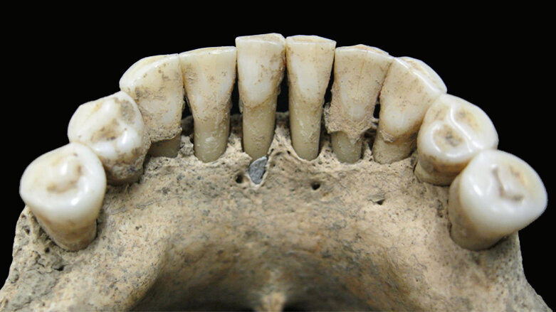 Das verrät Zahnstein über die Rolle der Frau im Mittelalter