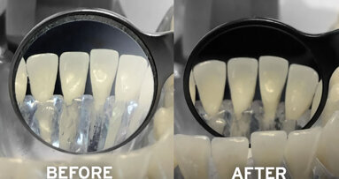 Perform at your best in diagnostic  and restorative