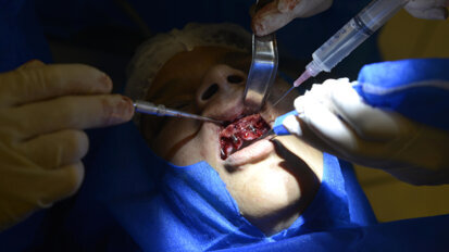 Brazilian dentists offer free dental help to victims of abuse Brazilian dentists offer free dental help to victims of abuse