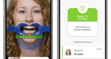 How Invisalign Virtual Care AI 3.0 benefits both practice and patients