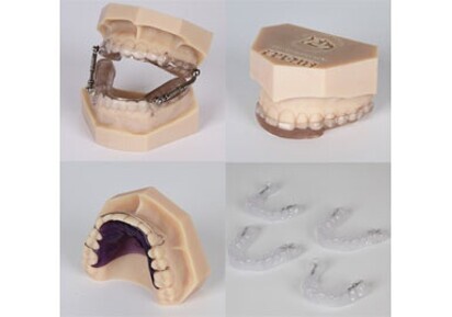 CEREC software for orthodontics