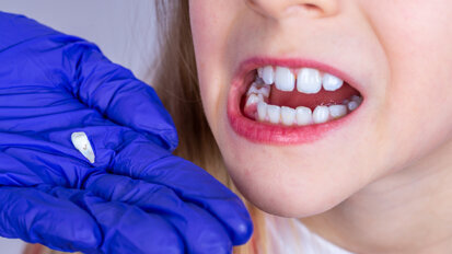 Growth lines of primary teeth may help evaluate risk of developing mental disorders