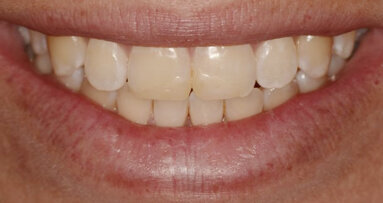 Color y forma: los objetivos de estética