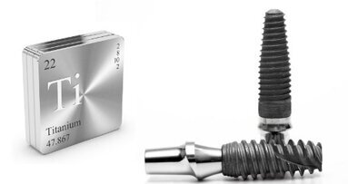 Titanium implants may carry risk of corrosion