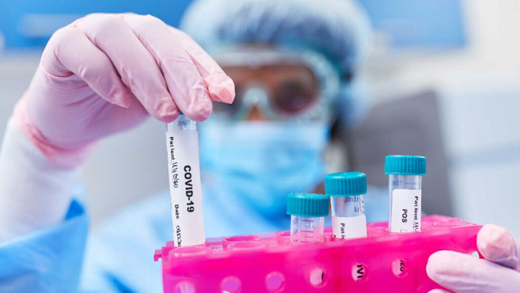 Teste de saliva para SARS-CoV-2 decola