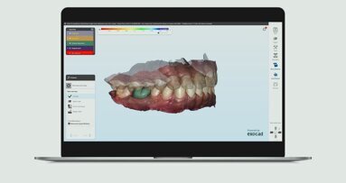 Align Technology introduces iTero Design Suite