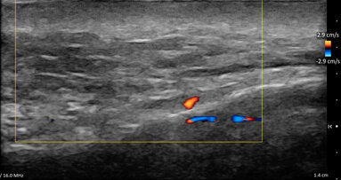 La rilevazione ecografica nella programmazione, nell’esecuzione e nel follow up dei piani terapeutici di medicina estetica del volto