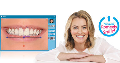 Участвайте в „Усмивка на годината 2015“ и спечелете софтуер за дизайн на усмивката