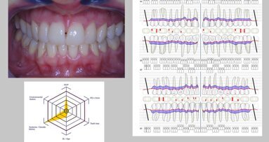 La prevención dental en pacientes diabéticos