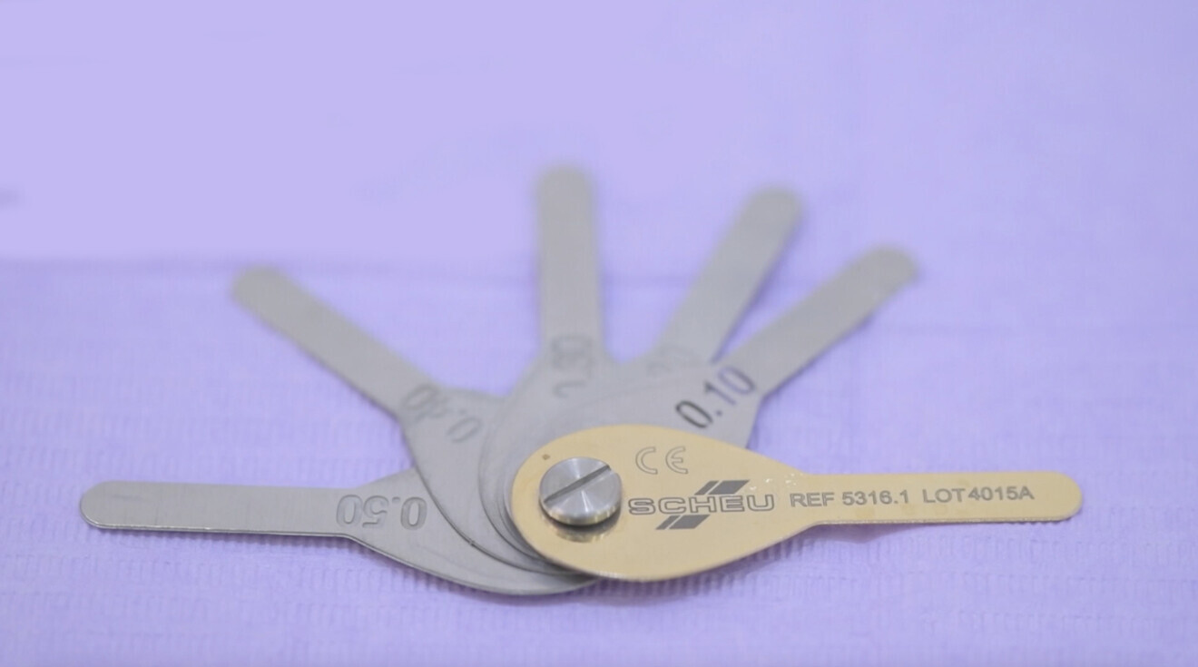 Fig. 3: The use of an IPR gauge is important.