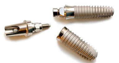 Critica dell'Associazione dei consumatori di Taiwan sul prezzo eccessivo degli impianti e le spese accessorie